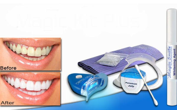 Teeth Whitening Magic Kit Plus