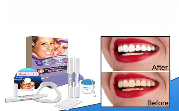 Teeth Whitening Magic Kit Pro