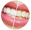 Teeth Whitening Toothpaste